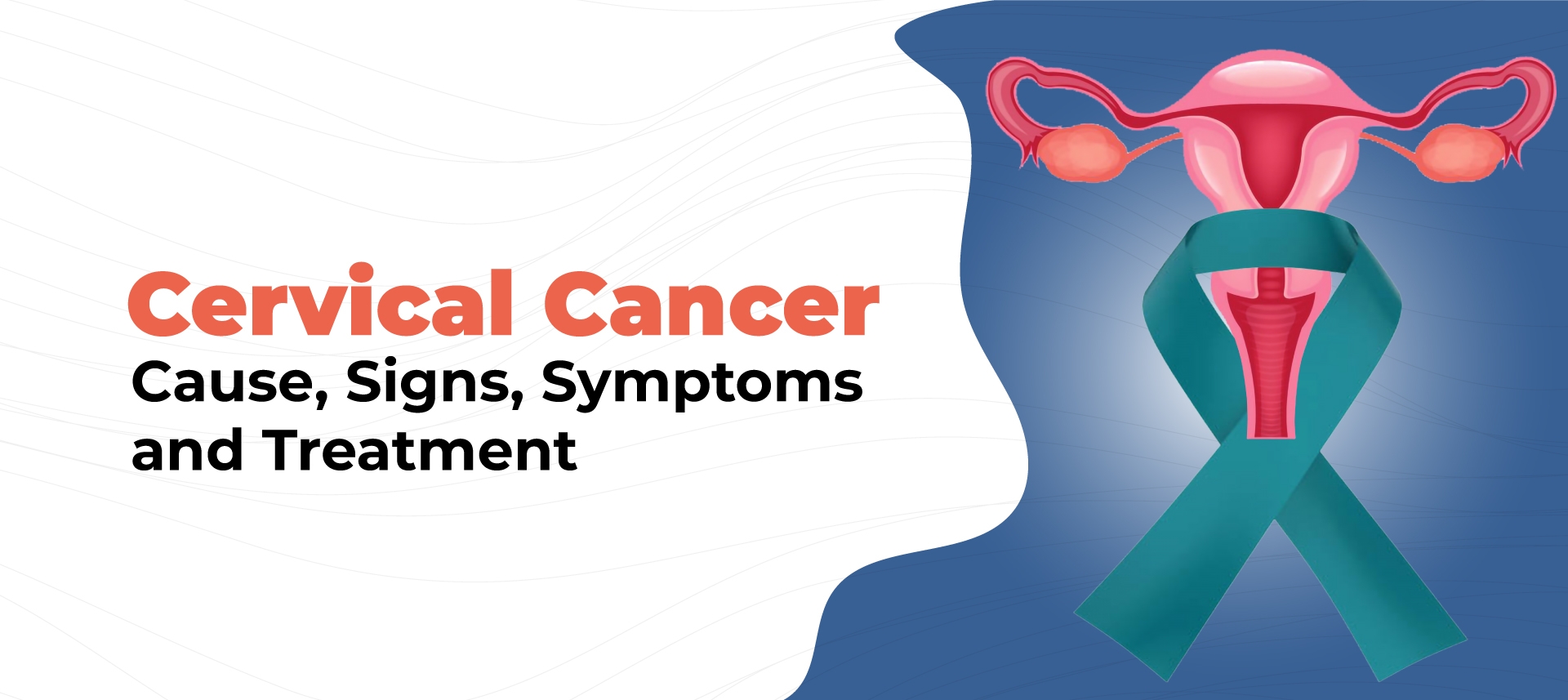 Cervical Cancer: Causes, Signs, Symptoms and Treatment - Rocket Health ...