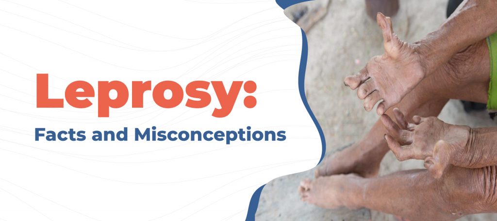 Leprosy-facts-and-misconceptions